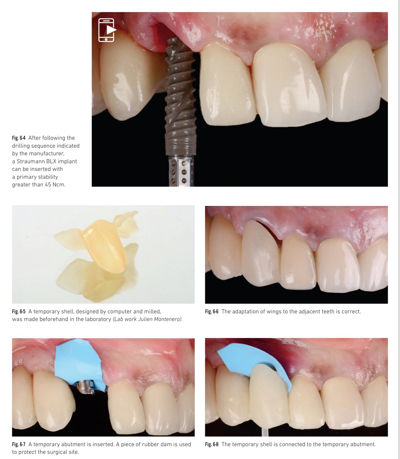 Clinical situation 6, page 3: Healing and control views