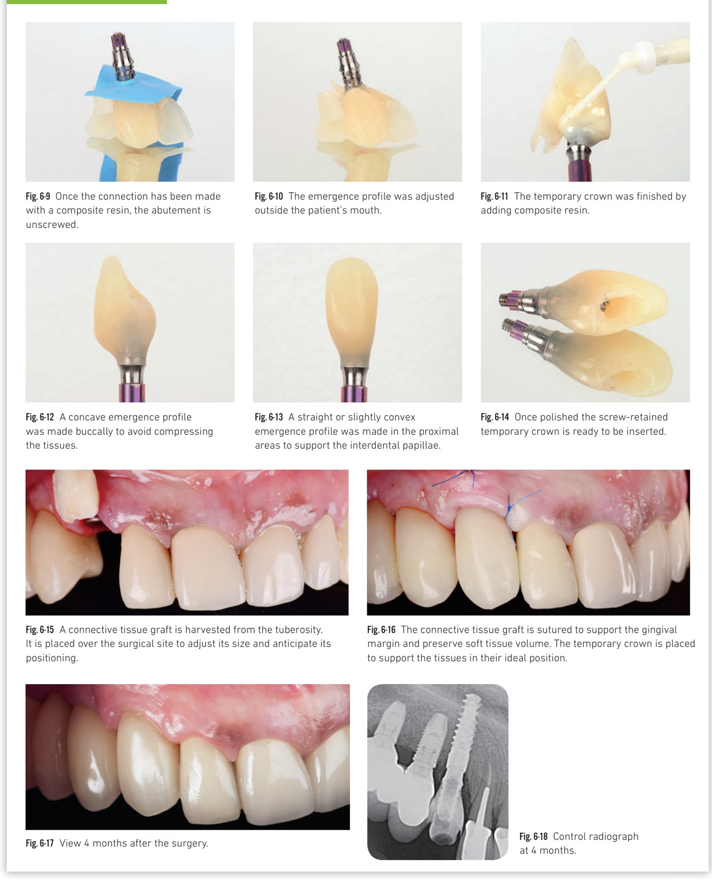 Clinical situation 7, page 1: Initial views and strategic extraction planning