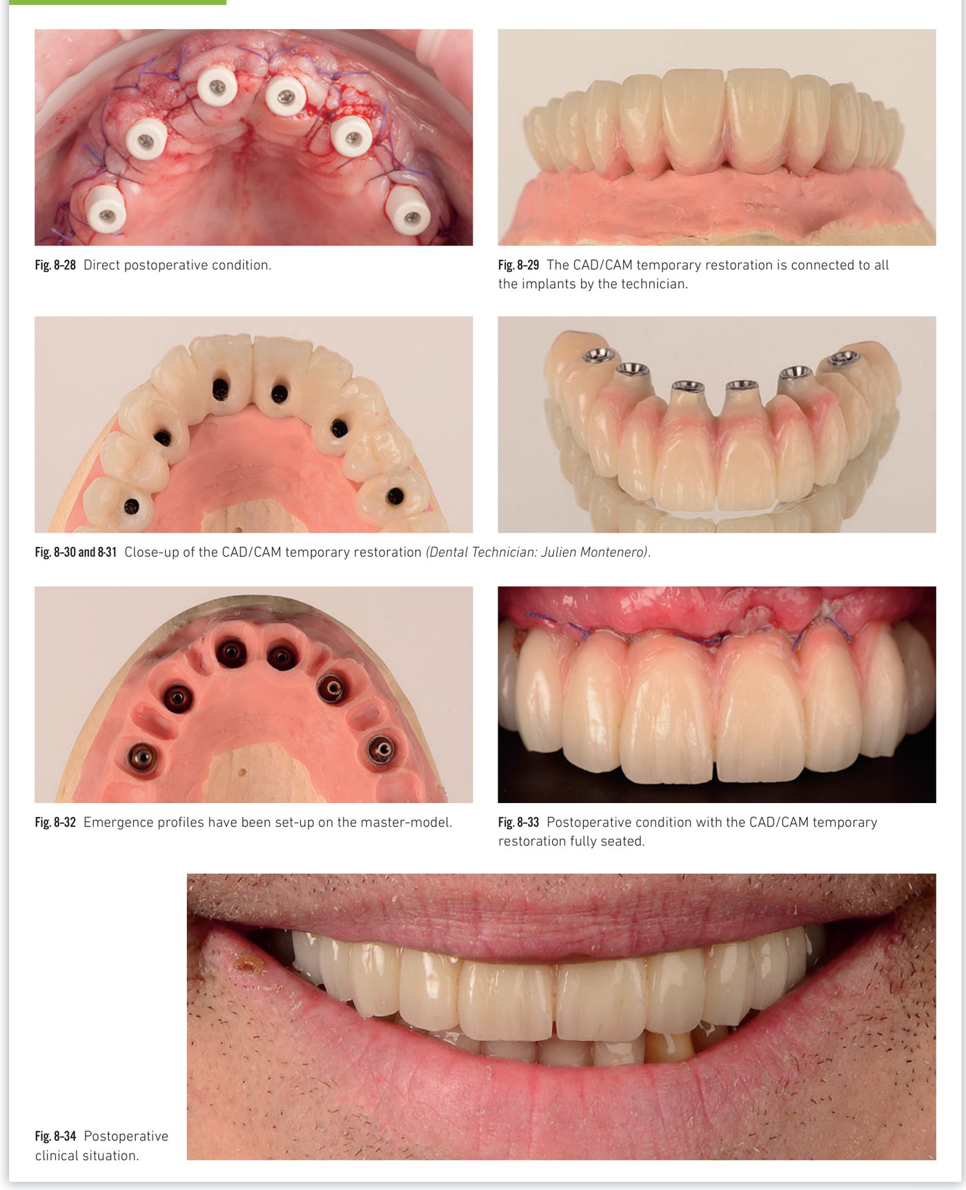 Clinical situation 8, page 6: Postoperative result and final X-ray