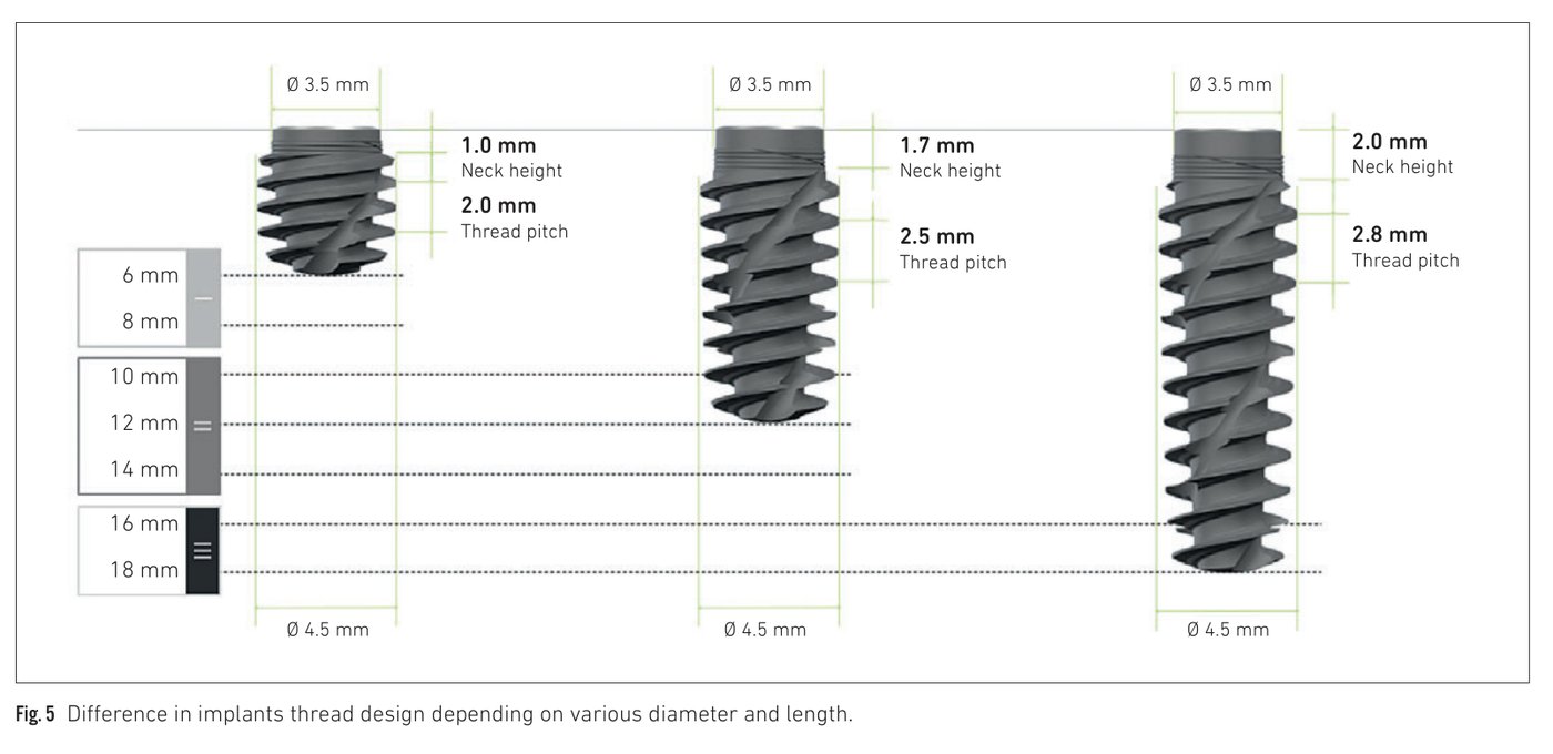 Fig 5: Difference in thread design depending on various implant diameter and length