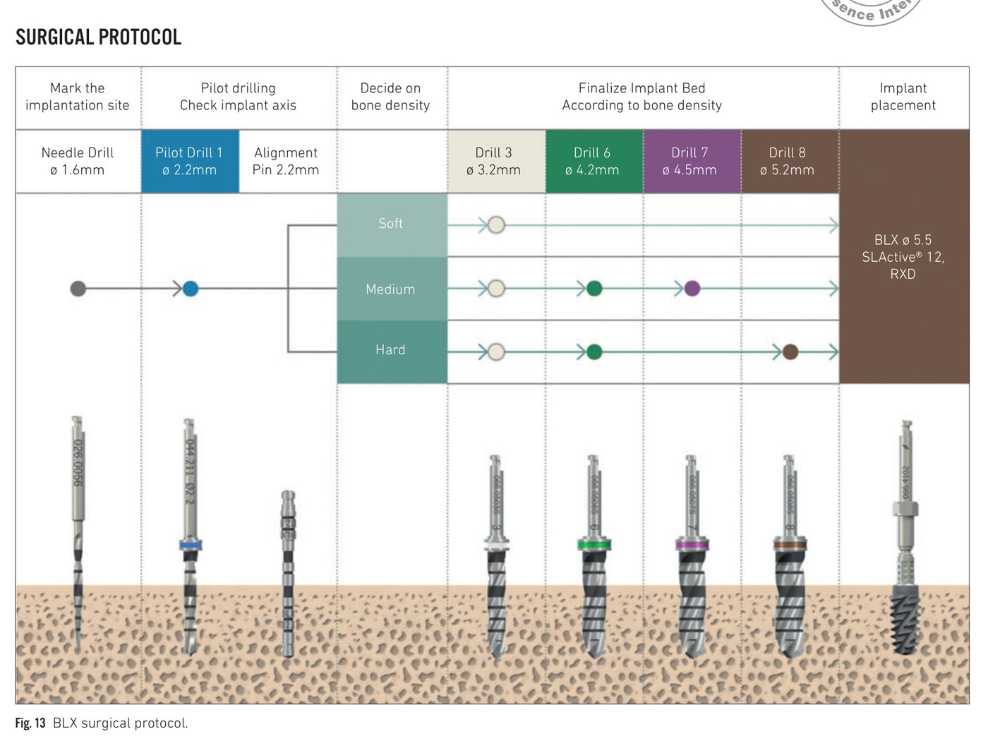 Fig 13: BLX surgical protocol chart showing drilling sequences for soft, medium, and hard bone