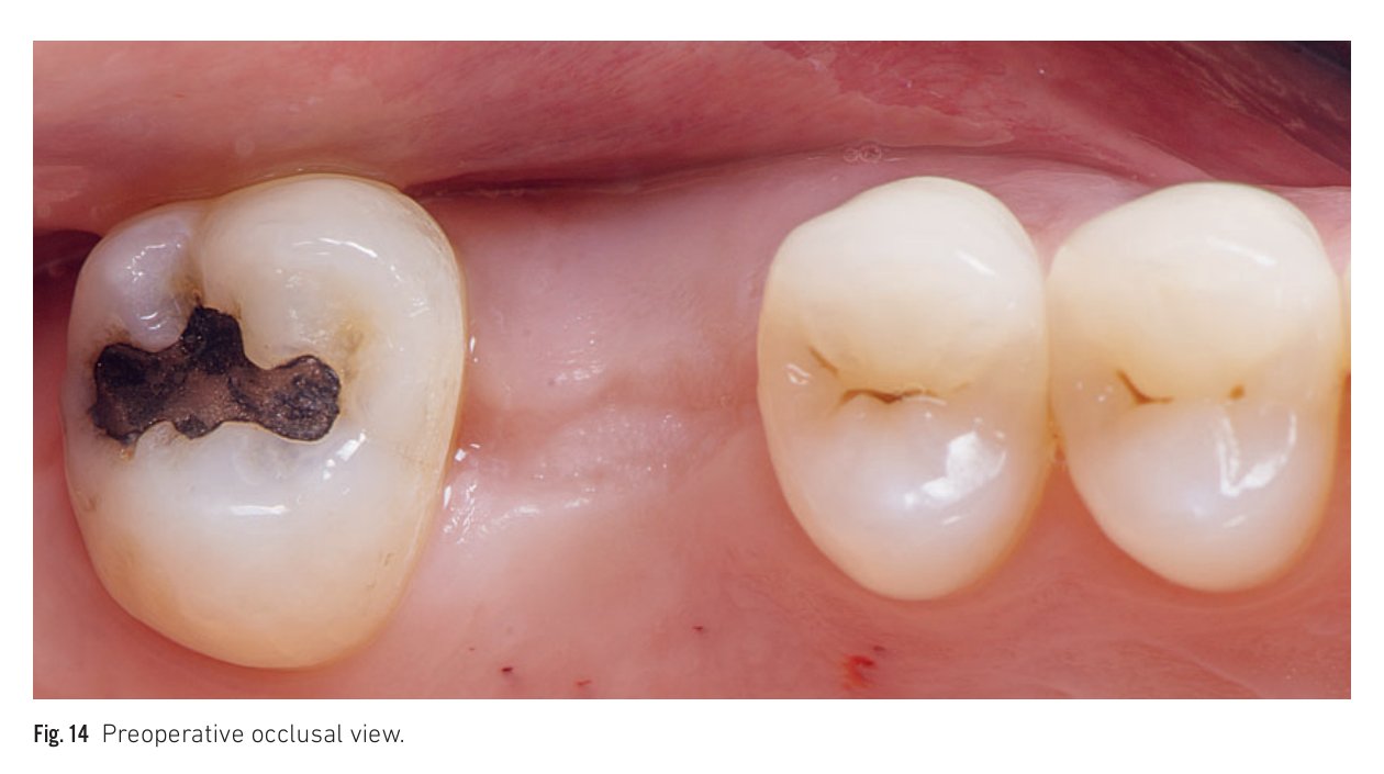 Fig 14: Preoperative clinical view