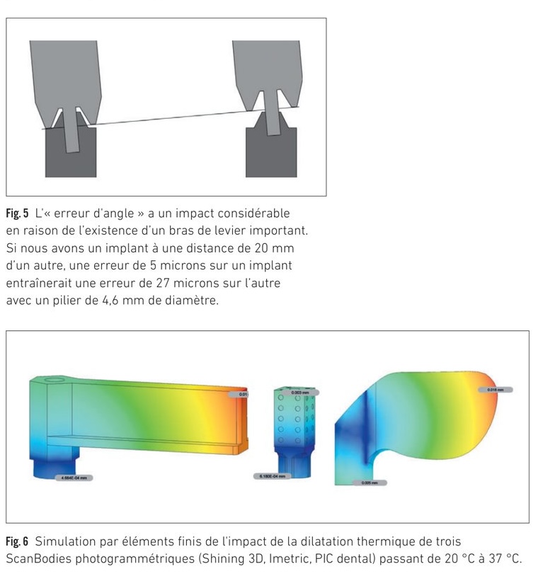 Impact du positionnement et de la morphologie des scanbodies — erreurs angulaires et effet de bras de levier