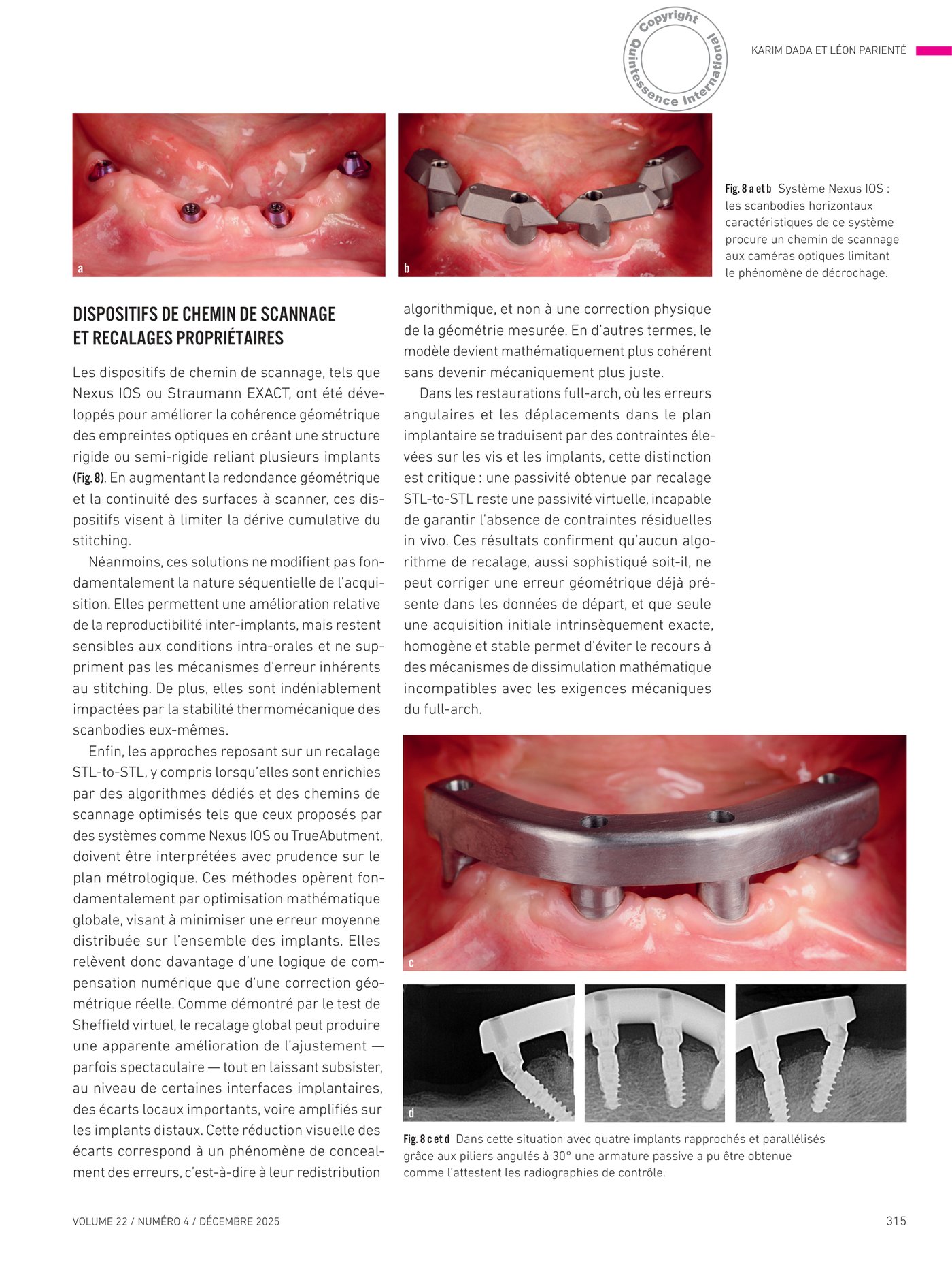 Système Nexus IOS — scanbodies horizontaux et chemin de scannage pour empreinte optique