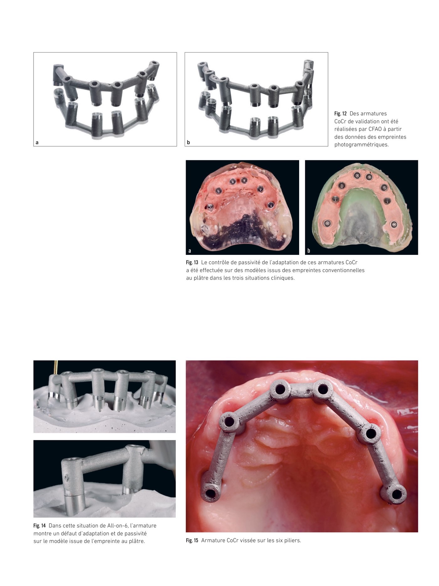 Résultats des tests de passivité sur armatures CoCr issues de la photogrammétrie PIC dental