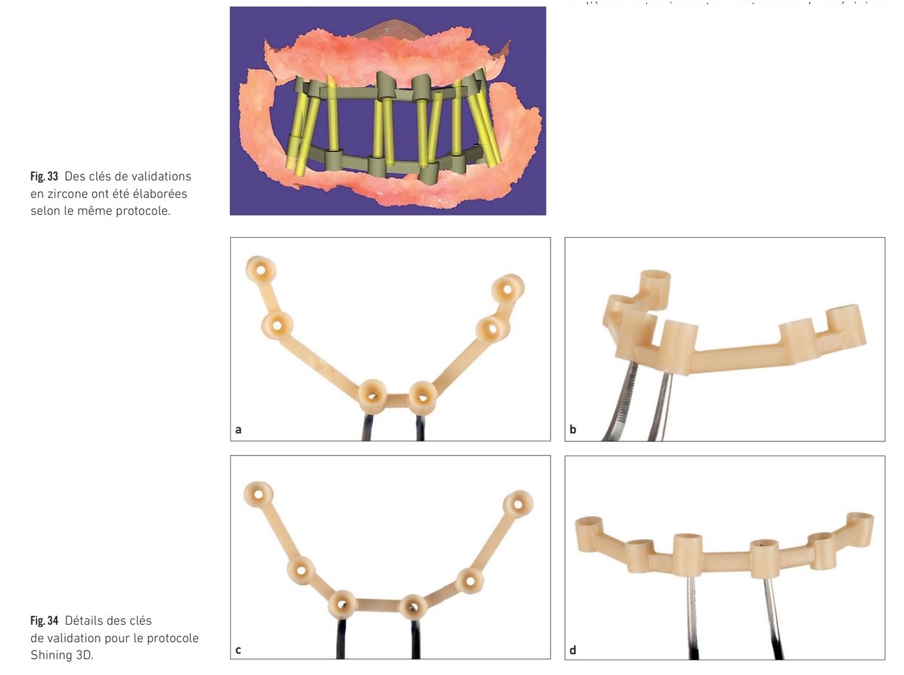 Résultats comparatifs entre scanner Shining 3D et flux photogrammétrique
