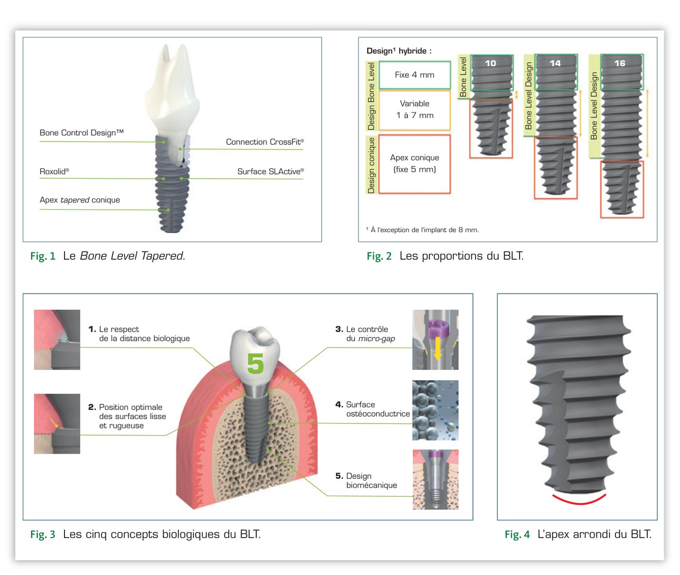 Fig. 1 à 4 — Le Bone Level Tapered : proportions, concepts biologiques et apex arrondi