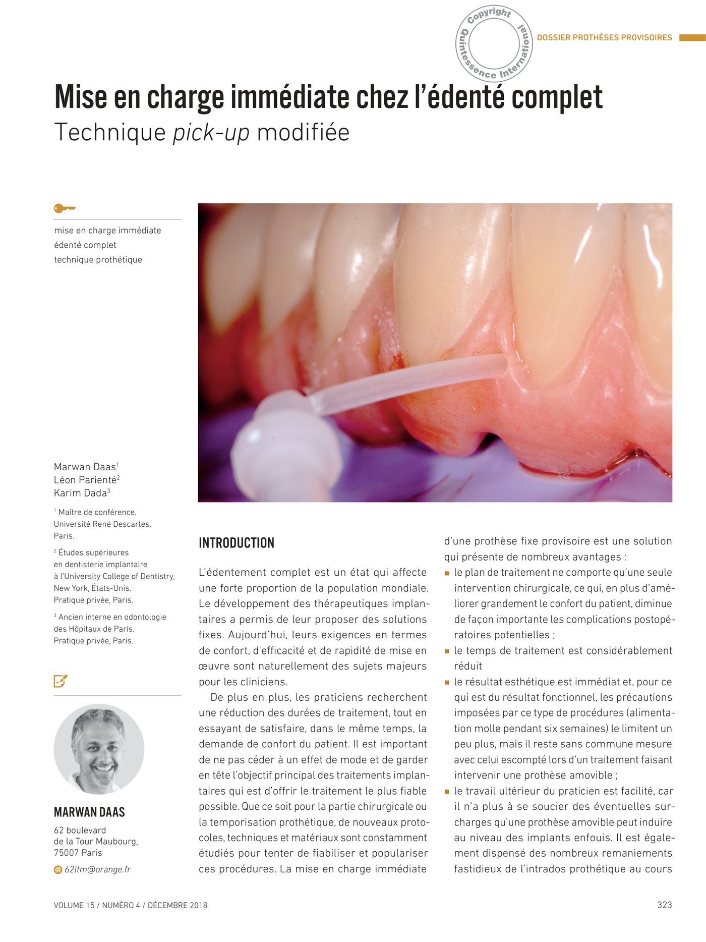 Mise en charge immédiate édenté complet — présentation de la technique pick-up modifiée
