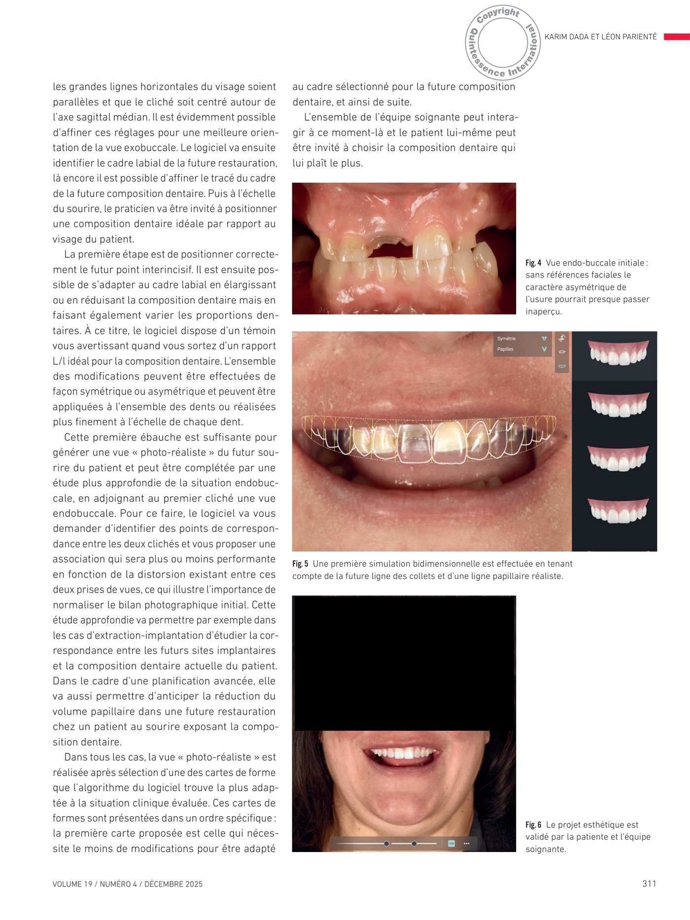Affinement de la proposition thérapeutique en 3D et modèle multicouche