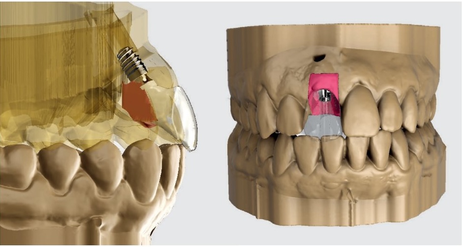 Protocole E-Merge — présentation et principe du transfert numérique du profil d'émergence