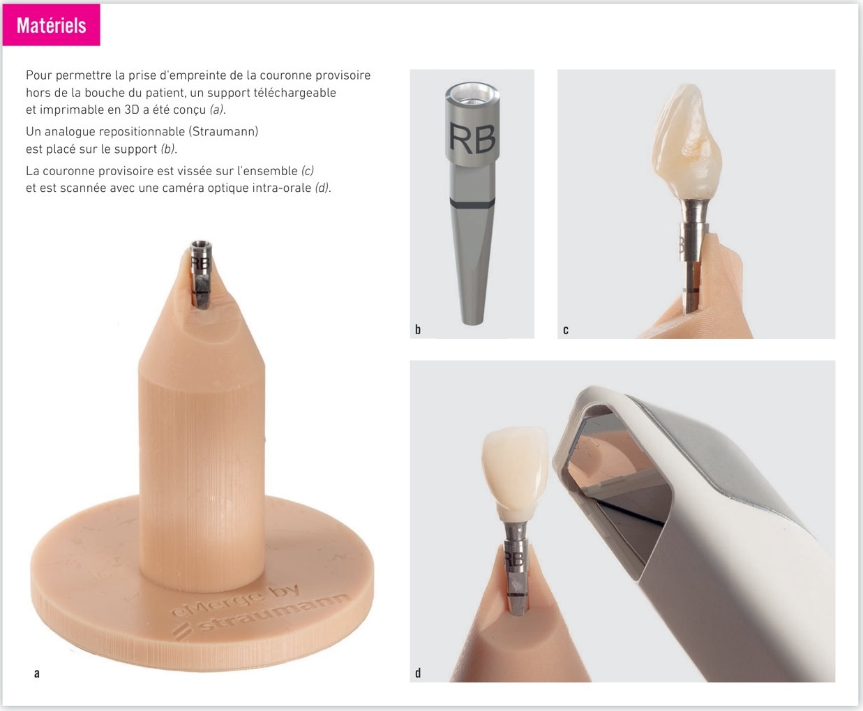 Matériels du protocole E-Merge — analogue repositionnable, support imprimé et scan de la provisoire