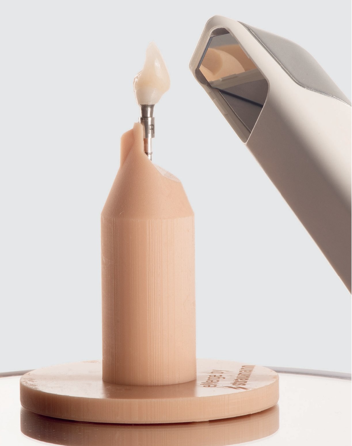 Situation clinique 1 — implantation immédiate, couronne provisoire et scan E-Merge