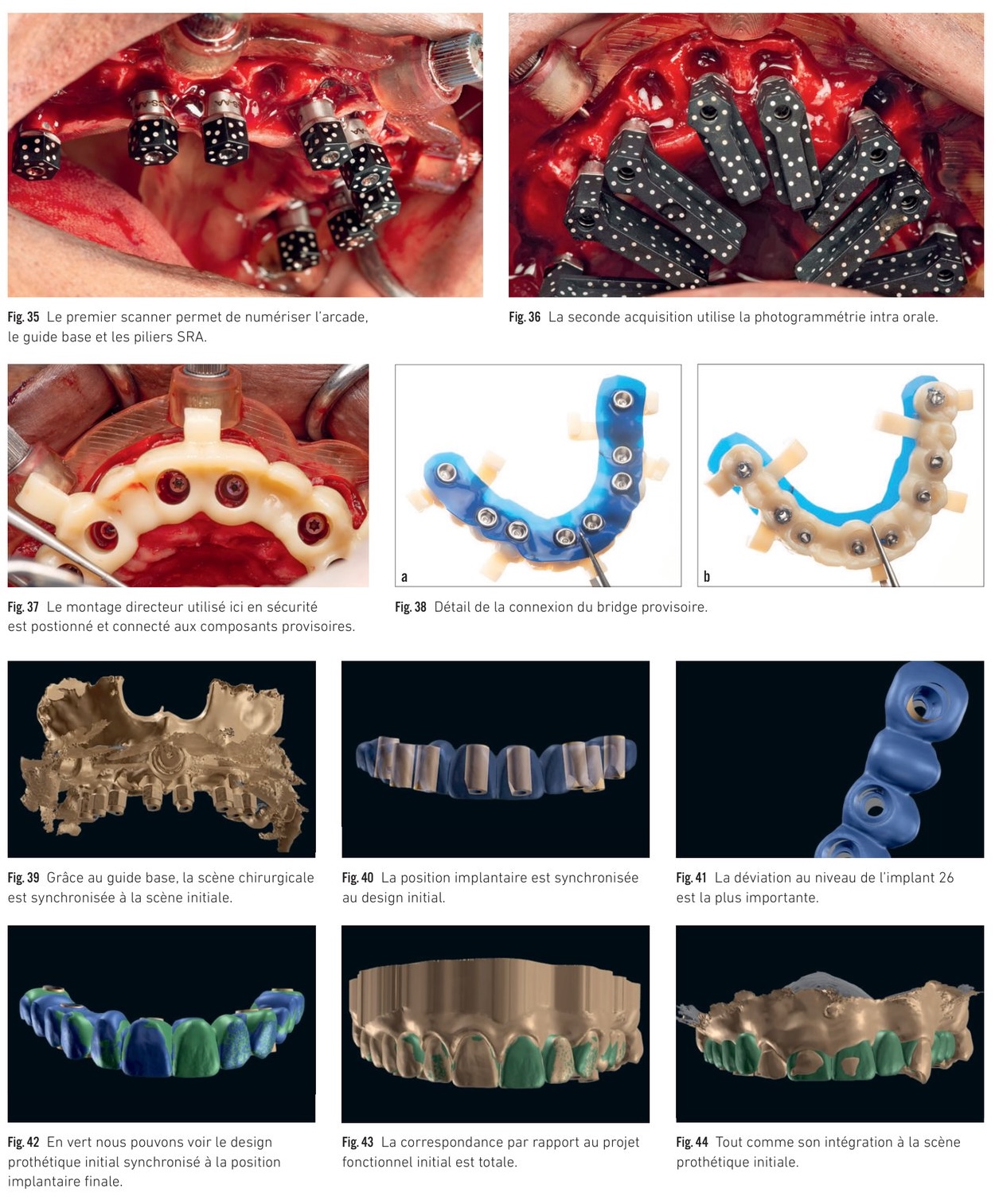 Exploitation des données SSP — synchronisation des scènes et fabrication du provisoire